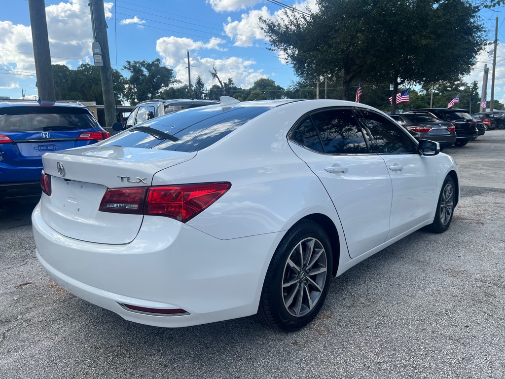 Photo 29 of this ACURA TLX